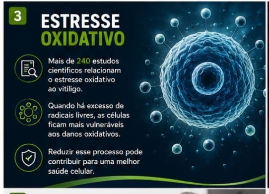 Estresse oxidativo: mais de 240 estudos científicos relacionam o estresse oxidativo ao vitiligo.